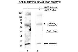 Western blot using  affinity purified anti-NAG-1/GDF15 (N-terminal specific) antibody shows detection of a 14 kDa band corresponding to recombinant human NAG-1 purified from CHO cells. (GDF15 anticorps  (N-Term))
