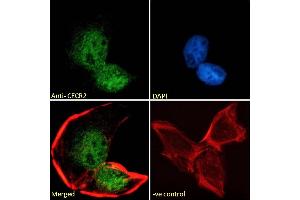 (ABIN184909) Immunofluorescence analysis of paraformaldehyde fixed U2OS cells, permeabilized with 0. (CECR2 anticorps  (C-Term))