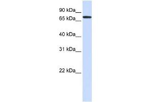 GALNT6 antibody used at 1 ug/ml to detect target protein. (GALNT6 anticorps)