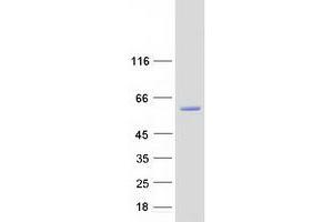 Validation with Western Blot