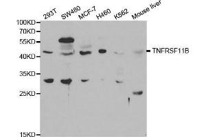 Western blot analysis of extracts of various cell lines, using TNFRSF11B antibody. (Osteoprotegerin anticorps  (AA 22-280))