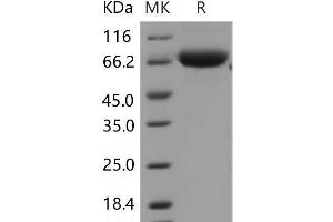 Western Blotting (WB) image for ADP-Ribosyltransferase 4 (Dombrock Blood Group) (ART4) protein (Fc Tag) (ABIN7320049)