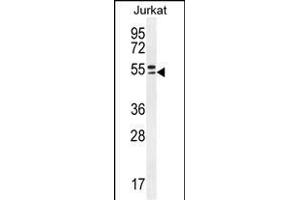 TRIM59 Antibody (N-term) (ABIN655580 and ABIN2845072) western blot analysis in Jurkat cell line lysates (35 μg/lane). (TRIM59 anticorps  (N-Term))