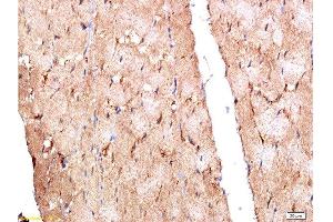 Formalin-fixed and paraffin embedded rat myocardium labeled with Anti-MuRF1/Trim63 Polyclonal Antibody, Unconjugated  at 1:200 followed by conjugation to the secondary antibody and DAB staining.