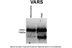 WB Suggested Anti-VARS Antibody Titration: 1 ug/mlPositive Control: Wildtype Neurospora crassa (VARS anticorps  (Middle Region))