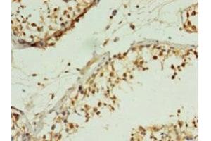 Immunohistochemistry of paraffin-embedded human testis tissue using ABIN7165811 at dilution of 1:100 (MIS12 anticorps  (AA 1-305))