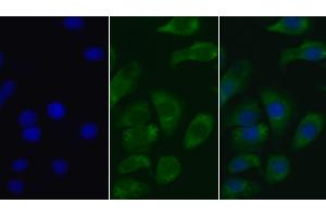 Detection of AMH in Human Hela cell using Monoclonal Antibody to Anti-Mullerian Hormone (AMH)