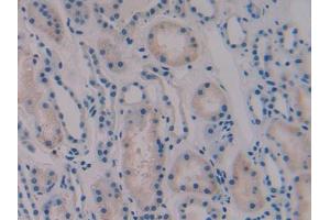 IHC-P analysis of Human Kidney Tissue, with DAB staining. (Vip anticorps  (AA 29-165))