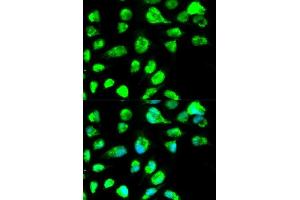 Immunofluorescence analysis of MCF-7 cells using LIG3 antibody. (LIG3 anticorps)