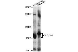 Western blot analysis of extracts of various cell lines, using SLC15A1 antibody (ABIN4905175) at 1:1000 dilution.