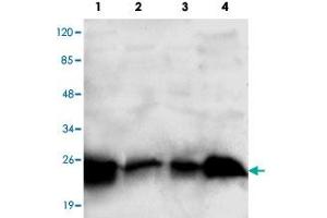 Western blot analysis of RAB2A monoclonal antibody  at 1:1000 dilution. (RAB2A anticorps  (C-Term))