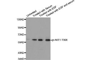 Western Blotting (WB) image for anti-V-Akt Murine Thymoma Viral Oncogene Homolog 1 (AKT1) (pThr308) antibody (ABIN1869972) (AKT1 anticorps  (pThr308))