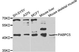 Western blot analysis of extracts of various cells, using PABPC5 antibody. (PABPC5 anticorps)