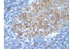 Image no. 1 for anti-Protein Inhibitor of Activated STAT, 2 (PIAS2) (C-Term) antibody (ABIN6736323)