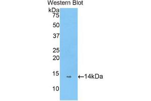 Western blot analysis of the recombinant protein. (PIN4 anticorps  (AA 23-130))