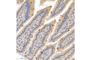 Immunohistochemistry of paraffin embedded mouse small intestine using PTPN3 (ABIN7075298) at dilution of 1:700 (300x lens)