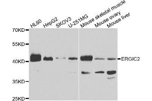 Western blot analysis of extracts of various cell lines, using ERGIC2 antibody. (ERGIC2 anticorps  (AA 55-310))