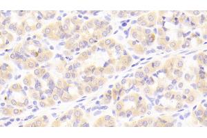 Detection of IkBa in Human Stomach Tissue using Polyclonal Antibody to Inhibitory Subunit Of NF Kappa B Alpha (IkBa)