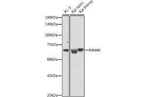 Western blot analysis of extracts of various cell lines, using RBM46 antibody (ABIN7270086) at 1:1000 dilution. (RBM46 anticorps  (AA 1-140))