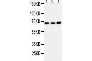 Western Blotting (WB) image for anti-Guanylate Binding Protein 1, Interferon-Inducible (GBP1) (AA 566-589), (C-Term) antibody (ABIN3042677) (GBP1 anticorps  (C-Term))