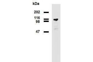 Western blotting analysis (reducing conditions) of PDE8a in HEK293T/17-PDE8a transfectants using mouse monoclonal antibody EM-52 . (PDE8A anticorps)