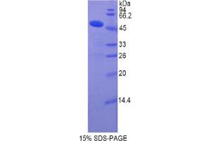 SDS-PAGE analysis of Human Collagen Type XIV Protein.