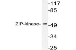 Western blot (WB) analysis of ZIP-kinase antibody in extracts from HuvEc cells. (DAPK3 anticorps)