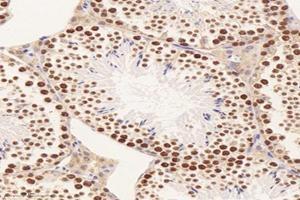 Immunohistochemistry analysis of paraffin-embedded mouse testis using,PPIL2 (ABIN7075005) at dilution of 1: 3600
