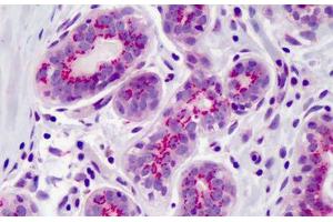 Anti-PPAR Delta antibody IHC of human breast. (PPARD anticorps  (AA 39-54))