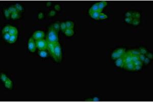 Immunofluorescent analysis of PC-3 cells using ABIN7152209 at dilution of 1:100 and Alexa Fluor 488-congugated AffiniPure Goat Anti-Rabbit IgG(H+L) (EIF5 anticorps  (AA 1-431))