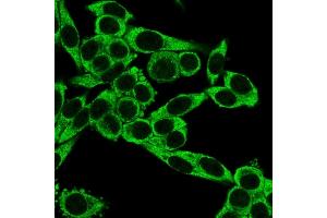 Immunofluorescence staining of PFA-fixed HeLa cells using CD195 Mouse Monoclonal Antibody (12D1) followed by goat anti-mouse IgG conjugated to CF488 (green).