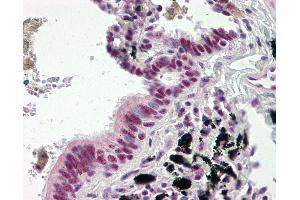Human Lung, Respiratory Epithelium: Formalin-Fixed, Paraffin-Embedded (FFPE)