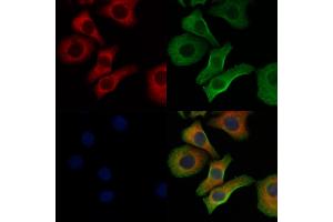 ABIN6260159 and ABIN6278363 staining Hela cells by IF/ICC. (AVPR1A anticorps  (C-Term))