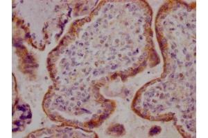 IHC image of ABIN7127321 diluted at 1:100 and staining in paraffin-embedded human placenta tissue performed on a Leica BondTM system.