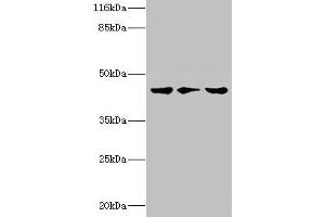 Western blot All lanes: PSKH2 antibody at 2 μg/mL Lane 1: Hela whole cell lysate Lane 2: Mouse heart tissue Lane 3: Rat gonad tissue Secondary Goat polyclonal to rabbit IgG at 1/10000 dilution Predicted band size: 44 kDa Observed band size: 44 kDa (PSKH2 anticorps  (AA 63-320))