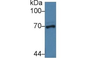 Detection of NUP62 in Porcine Liver lysate using Polyclonal Antibody to Nucleoporin 62 (NUP62) (NUP62 anticorps  (AA 186-432))