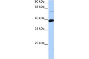 Western Blotting (WB) image for anti-Zinc Finger Protein 562 (ZNF562) antibody (ABIN2463443) (ZNF562 anticorps)