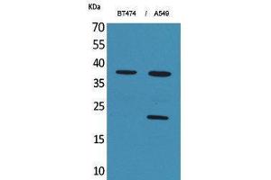 Western Blotting (WB) image for anti-Interferon, alpha 1 (IFNA1) (C-Term) antibody (ABIN3178201) (IFNA1 anticorps  (C-Term))