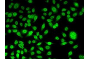 Immunofluorescence analysis of U2OS cells using PPL antibody (ABIN5974178). (PPL anticorps)