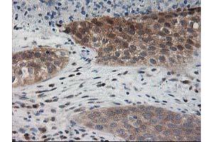 Image no. 8 for anti-Pyridoxal Kinase (PDXK) antibody (ABIN1500145)