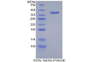 SDS-PAGE (SDS) image for Carboxypeptidase B1 (Tissue) (CPB1) (AA 109-415) protein (His tag) (ABIN1878938)