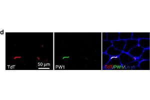 Specificity of Pdgfrβ-driven Cre.