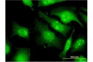 Immunofluorescence of monoclonal antibody to EIF2S3 on HeLa cell. (EIF2S3 anticorps  (AA 383-472))