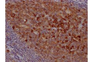 IHC image of ABIN7127402 diluted at 1:100 and staining in paraffin-embedded human tonsil tissue performed on a Leica BondTM system.