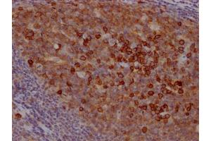 IHC image of ABIN7127402 diluted at 1:100 and staining in paraffin-embedded human tonsil tissue performed on a Leica BondTM system. (Recombinant CD38 anticorps)