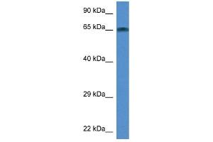 WB Suggested Anti-Taf6l Antibody Titration: 1. (TAF6L anticorps  (Middle Region))