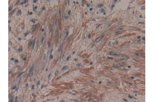 Detection of ANO6 in Human Prostate Tissue using Polyclonal Antibody to Anoctamin 6 (ANO6)