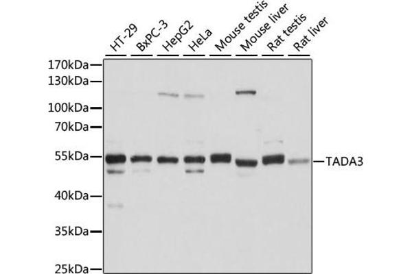 TADA3L anticorps  (AA 270-369)