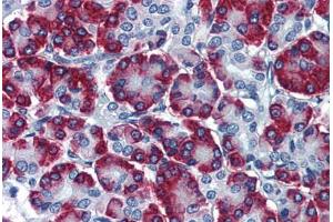 Human Pancreas: Formalin-Fixed, Paraffin-Embedded (FFPE) (SSR1 anticorps  (AA 33-287))