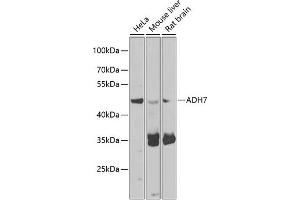 Western blot analysis of extracts of various cell lines, using  antibody (ABIN6131173, ABIN6136581, ABIN6136582 and ABIN6223850) at 1:1000 dilution. (ADH7 anticorps  (AA 1-386))